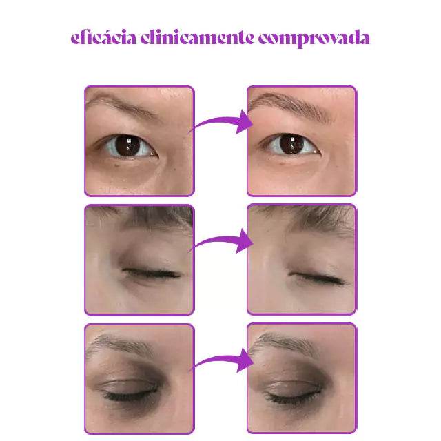 Luminous - Corretor de Olheiras Que Revitaliza e Clareia a Região dos Olhos [FRETE GRÁTIS] - Figma Store
