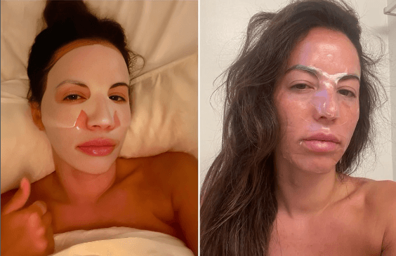 Biocollagen Plus - Máscara de Colágeno com Efeito Botox Instantâneo [40% OFF] - Figma Store