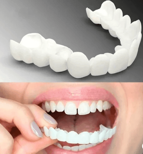 SmileFix Pro | Facetas Dentárias Naturais Removíveis [Últimas Unidades] - Figma Store