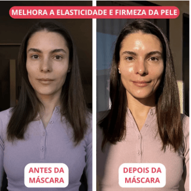 Biocollagen Plus - Máscara de Colágeno com Efeito Botox Instantâneo [40% OFF] - Figma Store