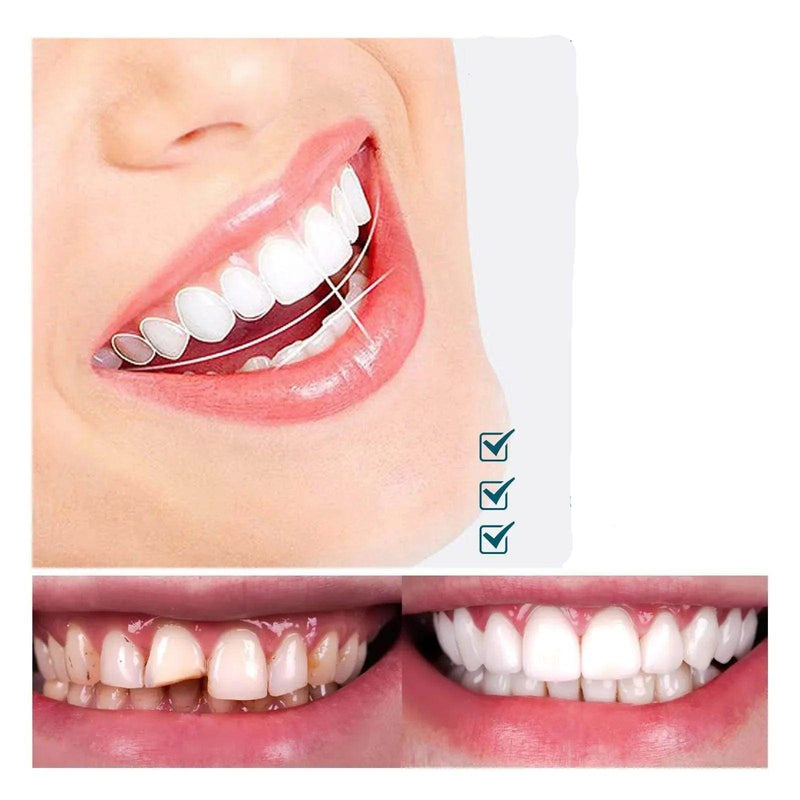 SmileFix Pro | Facetas Dentárias Naturais Removíveis [Últimas Unidades] - Figma Store